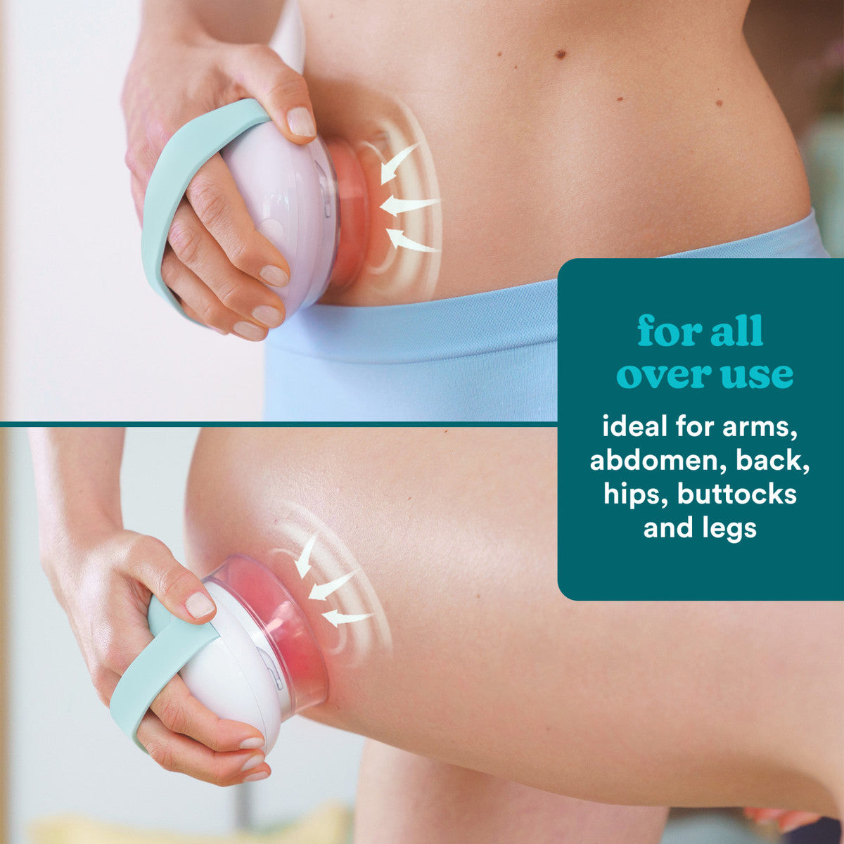 HoMedics Smoothee IR Cellulite Smoother