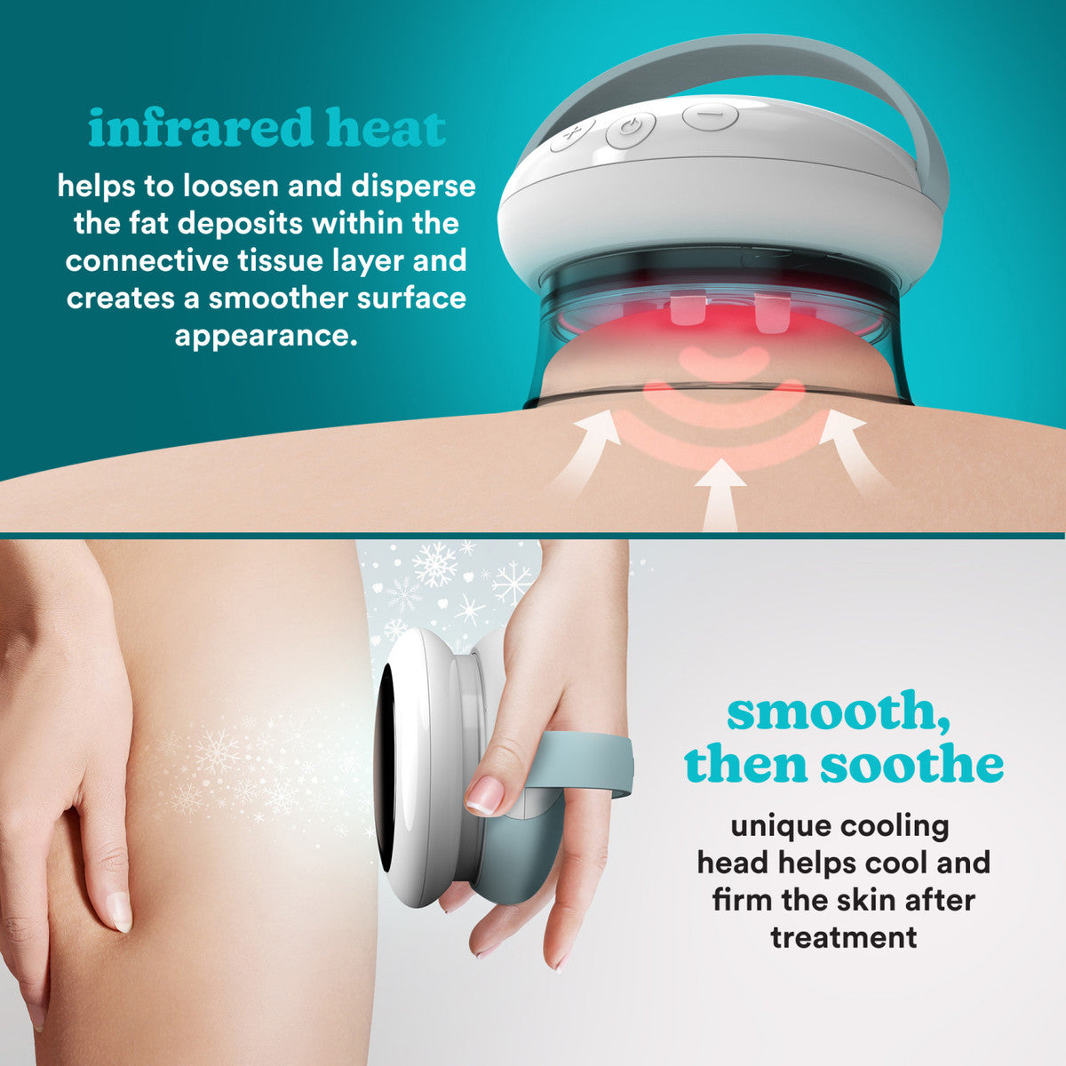 HoMedics Smoothee IR Cellulite Smoother